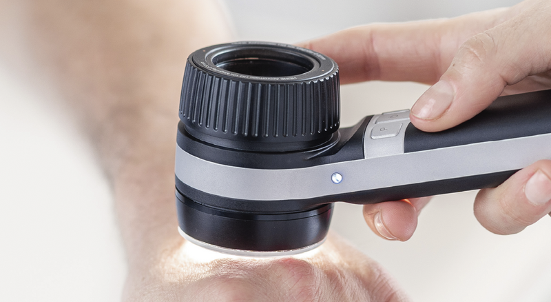Dermatoscopia digitale con dermatoscopio professionale Bio-Clinic Sassari